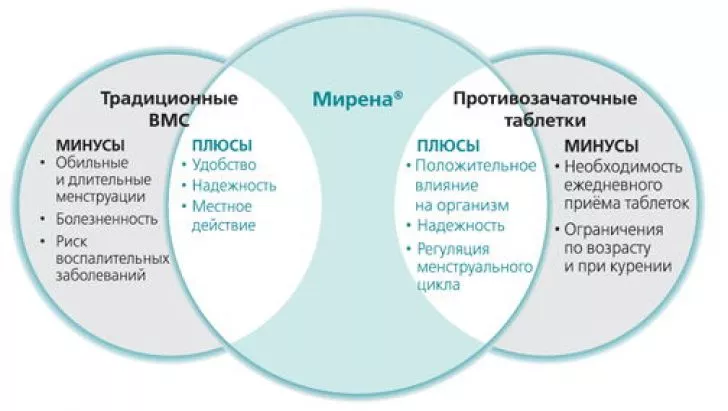 Преимущества спирали Мирена